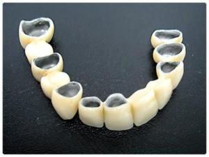 Лечение зубов в Китае. Кабальтохромовая легированная коронка
